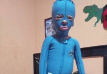 Chuchito Lanza un Llamado de Auxilio: ¡Tu Ayuda es Vital!