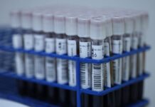 Conoce los beneficios de donar sangre de manera altruista: SSM